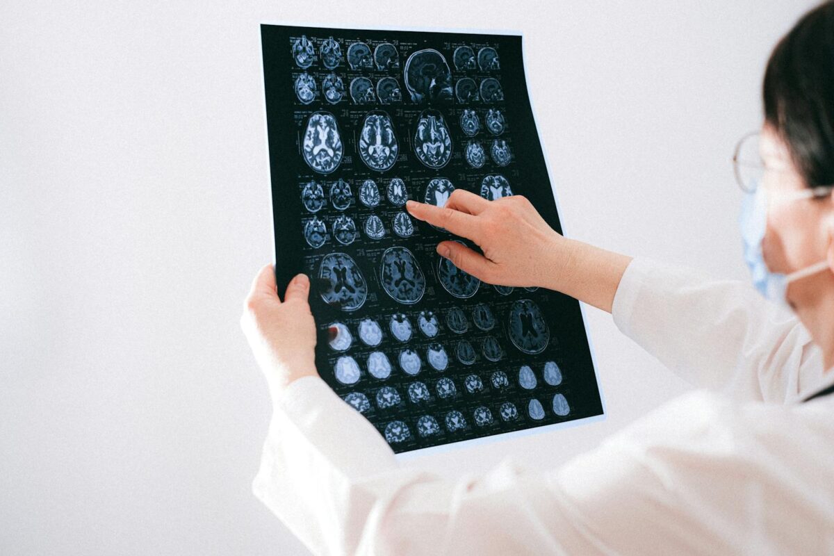 Huntington's Disease - Doctor examines brain MRI scans closely for medical diagnosis in a hospital environment.