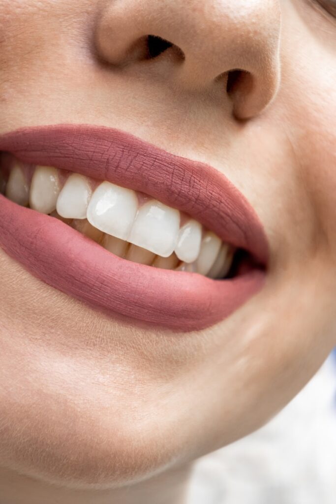 teeth, a close up of a woman's mouth with white teeth