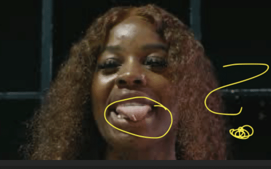 Eating Toenails -My Strange Addiction