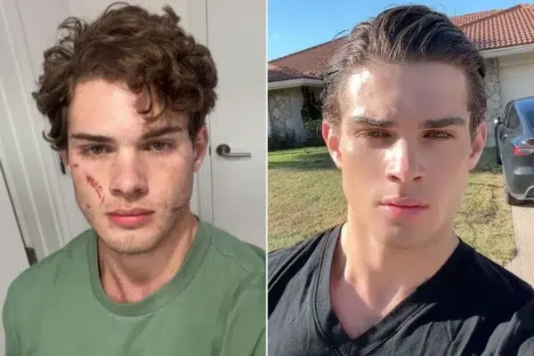 Clavicular Just Hospitalized After Unsettling Livestream