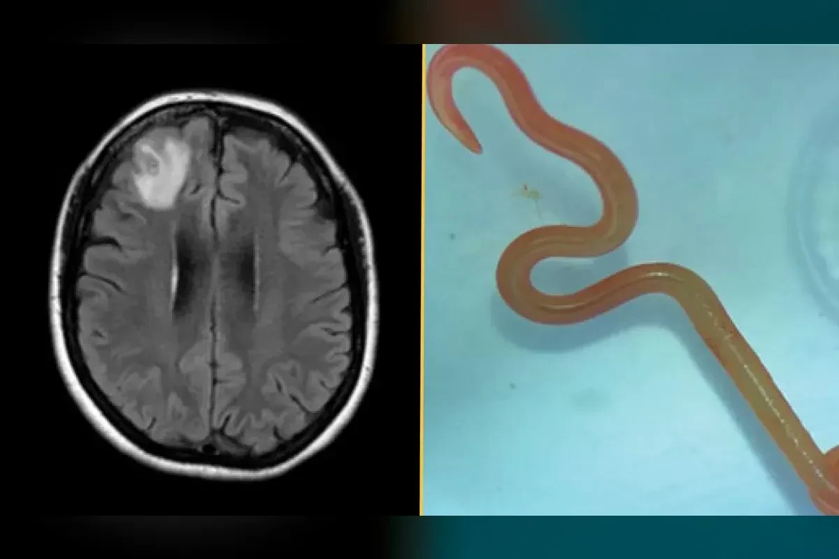 New Parasite Found in Northwest Threatens Women's Health Like Never Before New Parasite Found in Northwest Threatens Women's Health Like Never Before