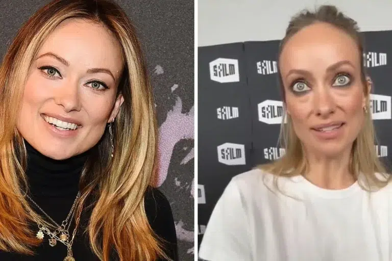 Olivia Wilde's face battle linked to brutal Harry Styles split.